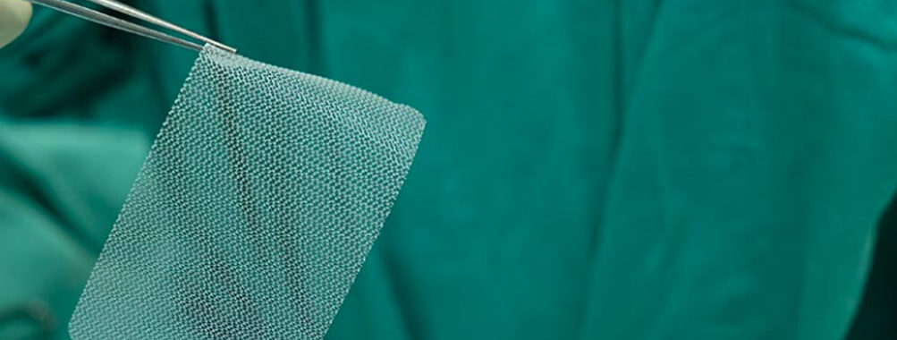 test Non-mesh Repairs